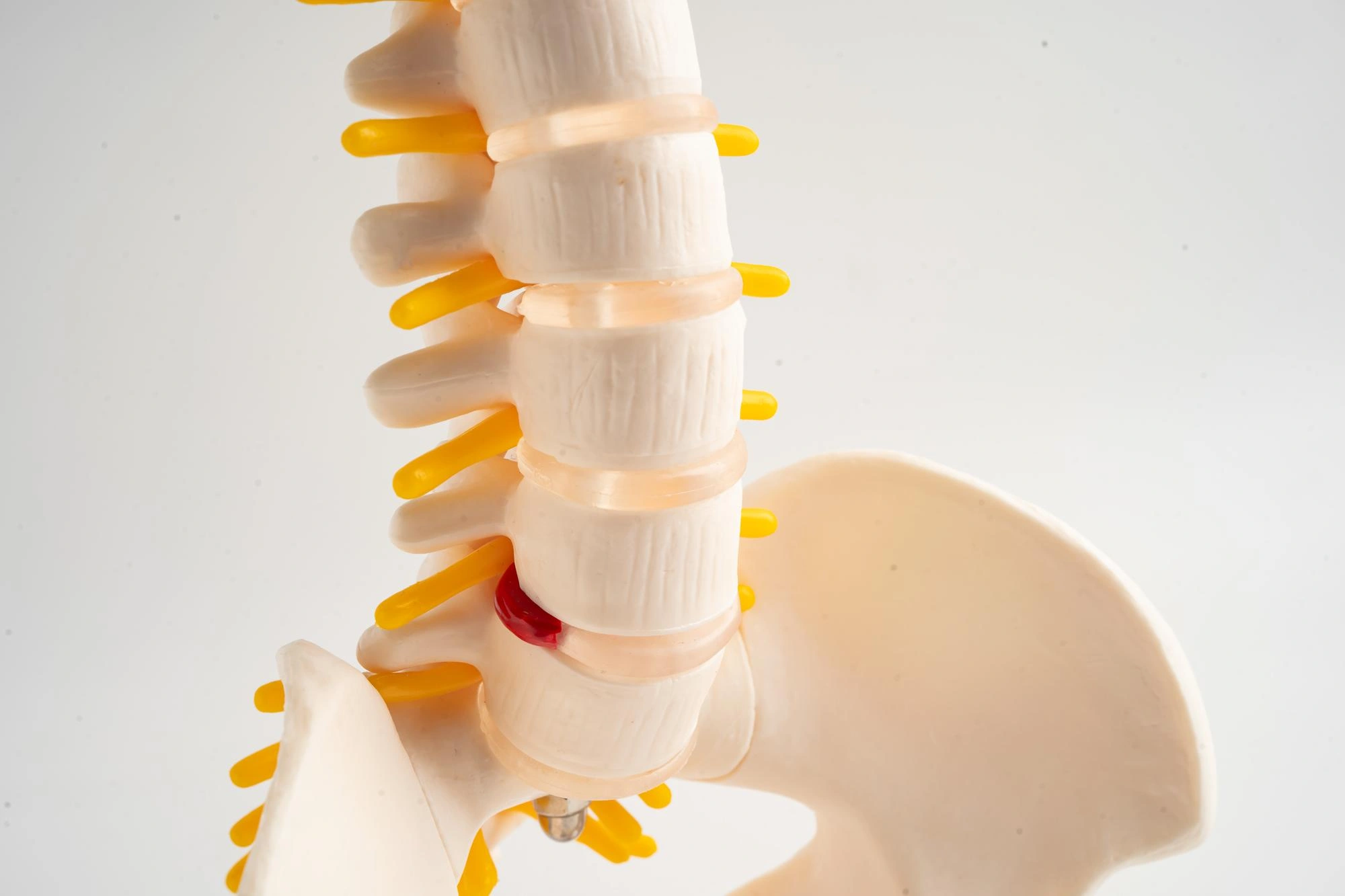 herniated-disc-banner