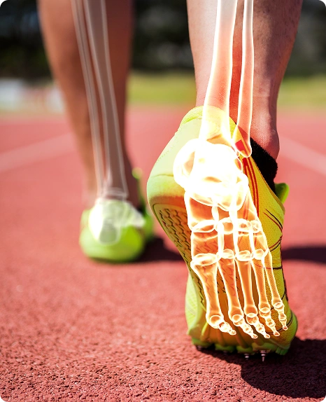 Orthotics Help Relieve Plantar Fasciitis